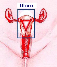 Utero - Isterectomia