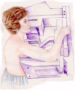Die Mammographie