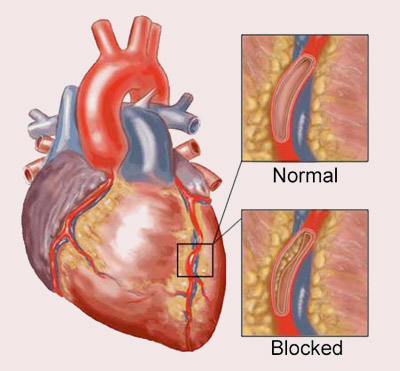Cardio Vascular Group 81
